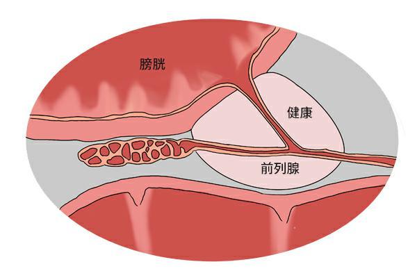 南京前列腺炎哪家男科看的好