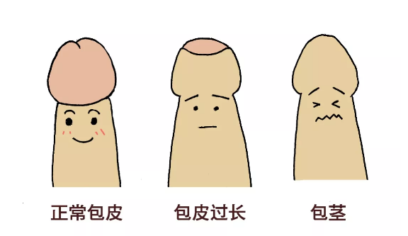 做包皮手术警惕低价陷阱,选择正规的南京邦德医院