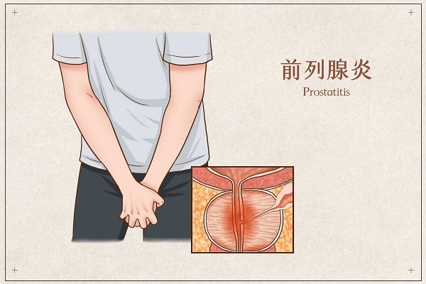 南京邦德中医院解答:前列腺炎的诱发因素有哪些呢?
