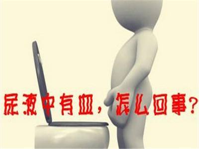 南京邦德中医院解答:尿液中有血是怎么回事?