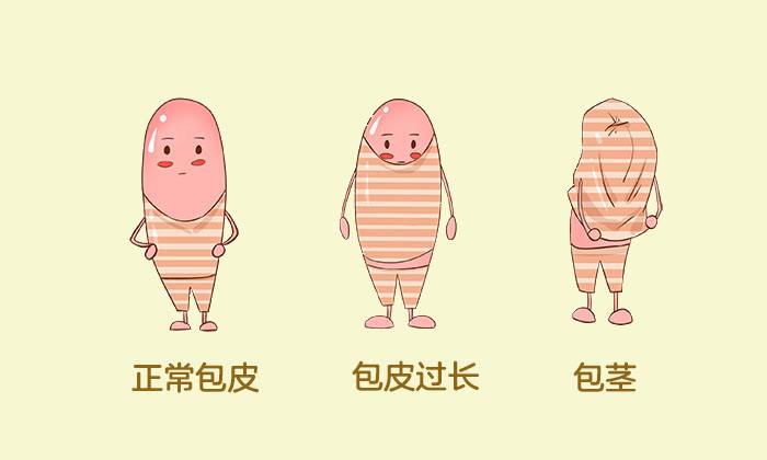 常见的生殖疾病包皮和包茎，不容忽视应该及时治疗