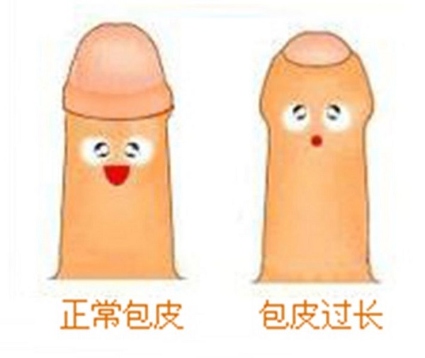 南京邦德中医院医生提示:青春期男生包茎尽量不要自己翻