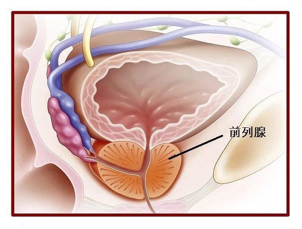 前列腺痛常见症状有哪些?