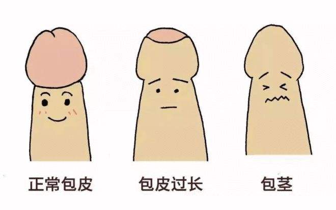 包皮包茎对男性都有哪些危害?